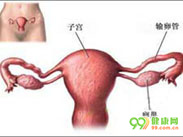 过敏性阴道炎